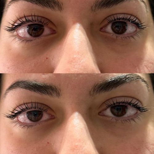 Lashlift